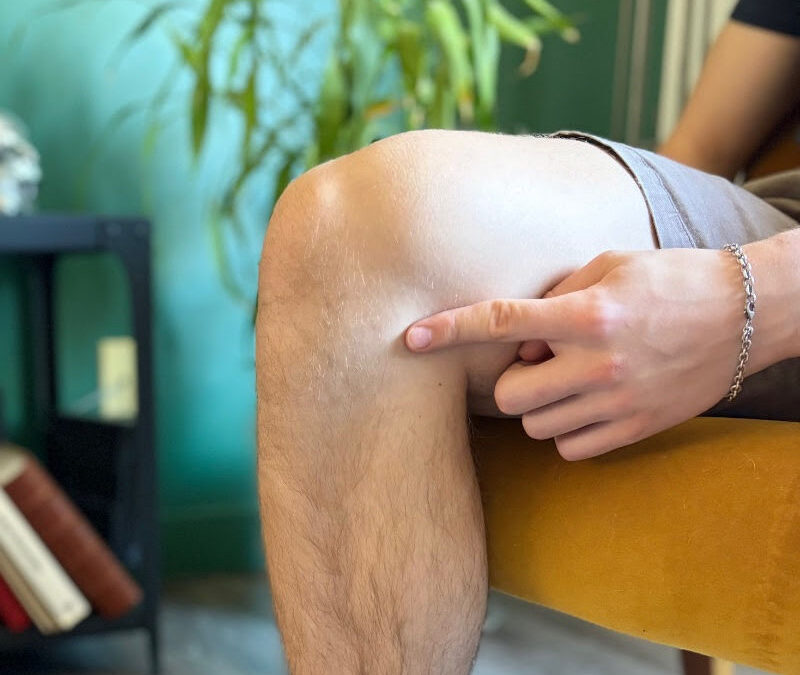 trigger point on knee